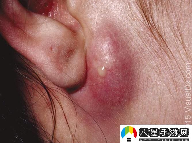硬疙瘩圖片引爆科技圈