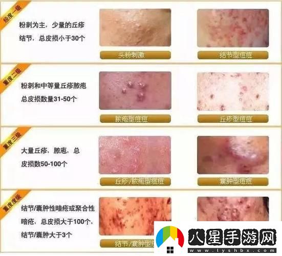女性三角毛毛區(qū)長(zhǎng)了個(gè)硬疙瘩