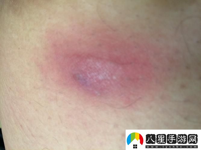 科技江湖突現(xiàn)「身體疙瘩俠」