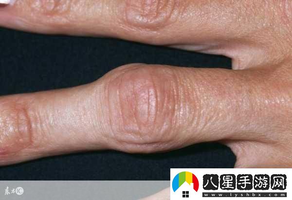 寶寶怎么才三根手指就痛1.寶寶為何三根手指就感到疼痛