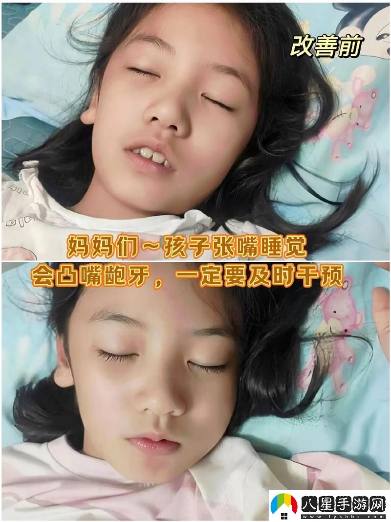 深入解析“小嘴無力合攏紅腫外翻圖片”背后的醫(yī)學意義