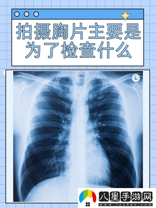100%胸片曝光率軟件可以直接看揭秘